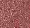 Dischi Tranciati / Adesivi / Velcro - Agglomerato - TELA Poliestere - serie NC75Y